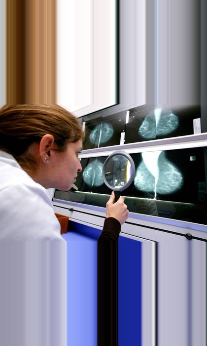 The technology should be able to help radiologists spot potential risks sooner. Credit: Phanie / Alamy Stock Photo