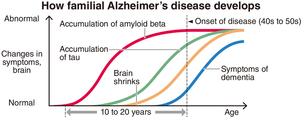 New Clinical Trials for Alzheimer's 3